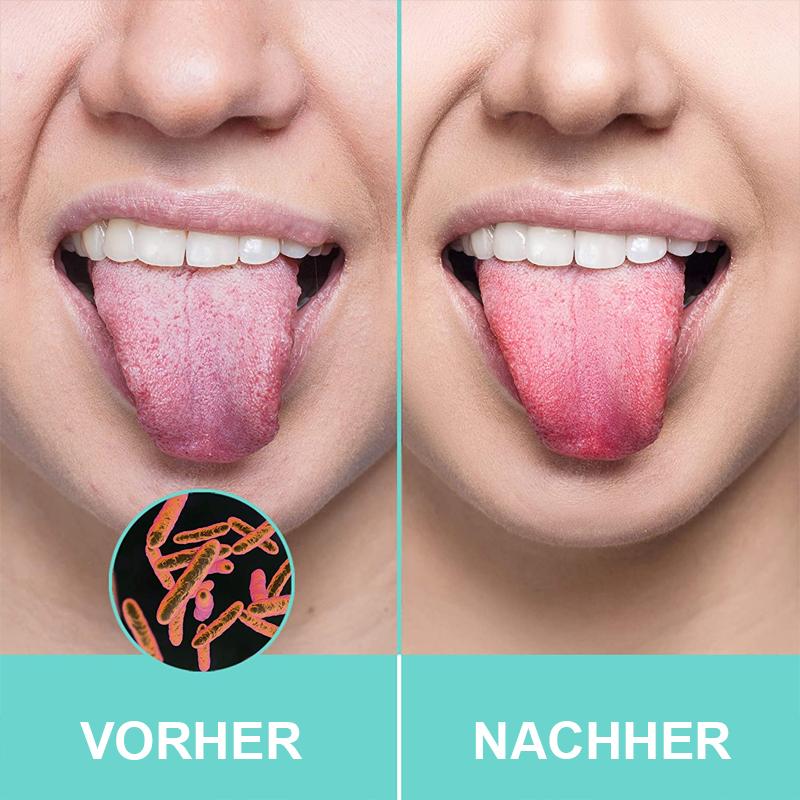 Zungenschaber aus Edelstahl