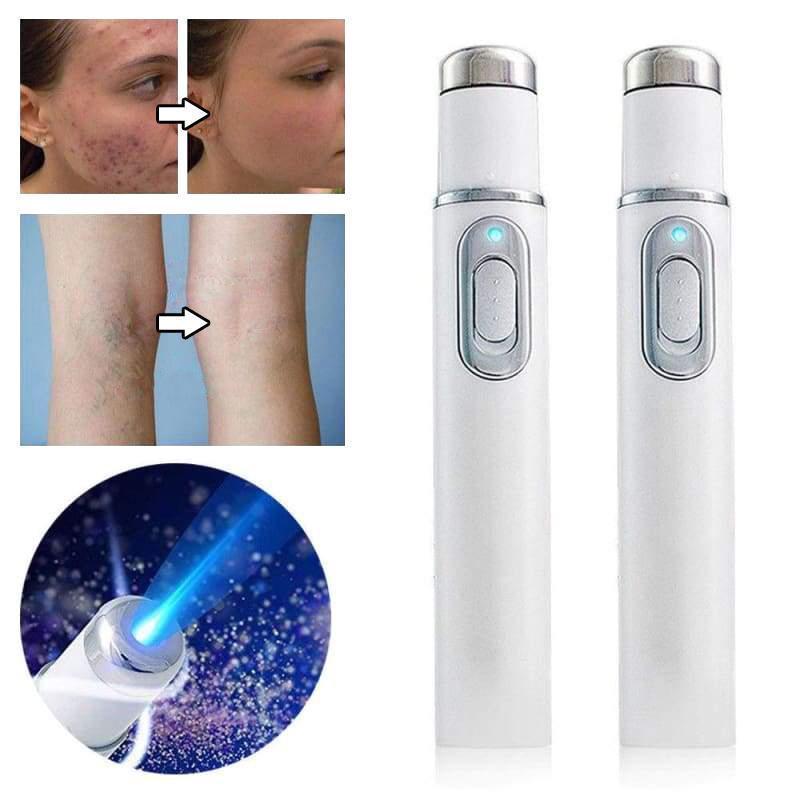 Laserbehandlung-Stift Blu-Ray unerwünschte Akne entfernen