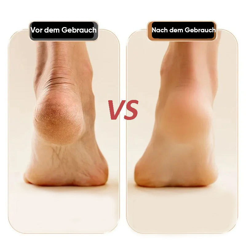🔥Heißer Verkauf 49% Rabatt🔥2024 Neues USB-Ladegerät für Fußreparaturen und Schleifen