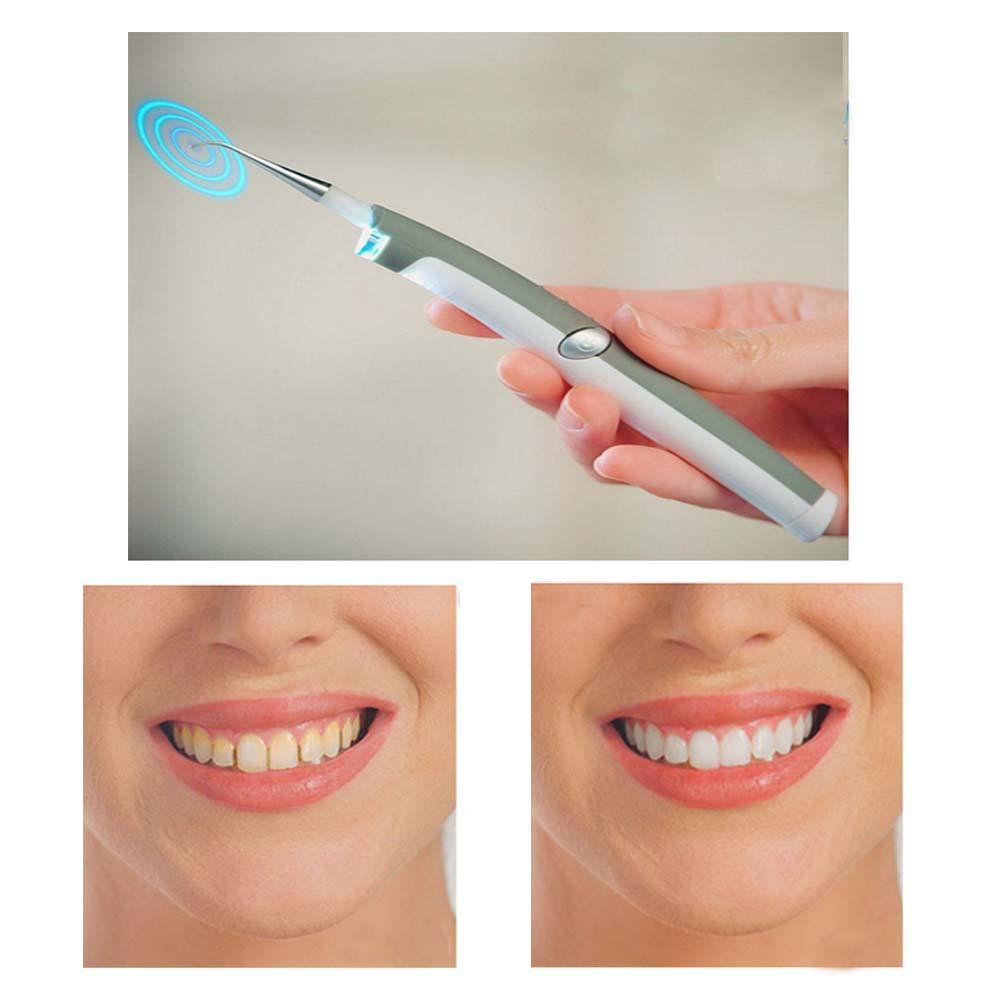 Sonic Zahnaufhellung Dental Tool