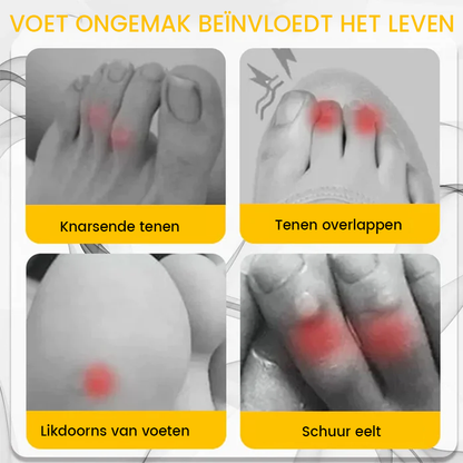 ilicone anti-friction toe protector